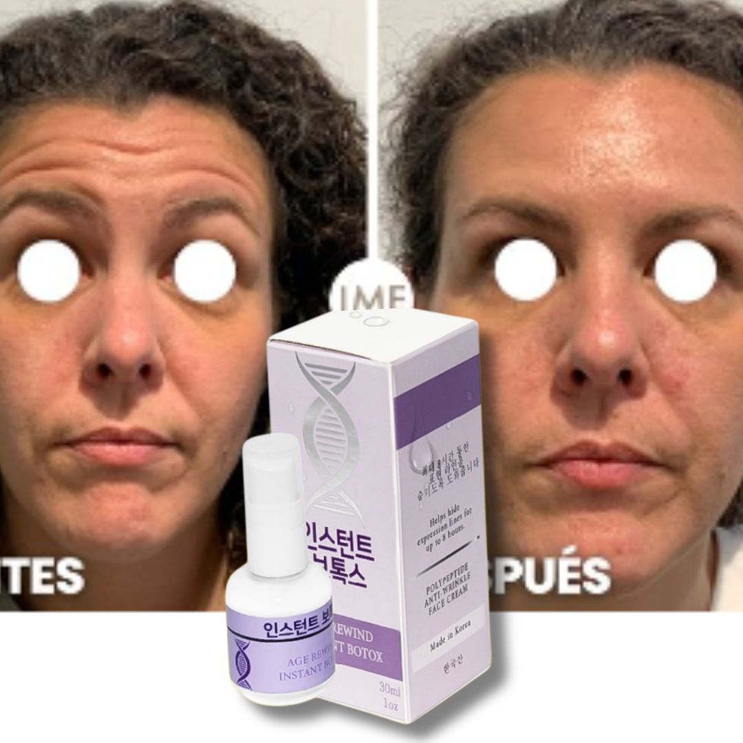 PerfectSkin🔥Crema de Botox instantánea- formula Coreana Nueva Presentación!