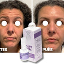 PerfectSkin🔥Crema de Botox instantánea- formula Coreana Nueva Presentación!