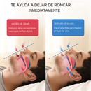 Air Flow Detiene los ronquidos recomendado por médicos de Europa Original🔥